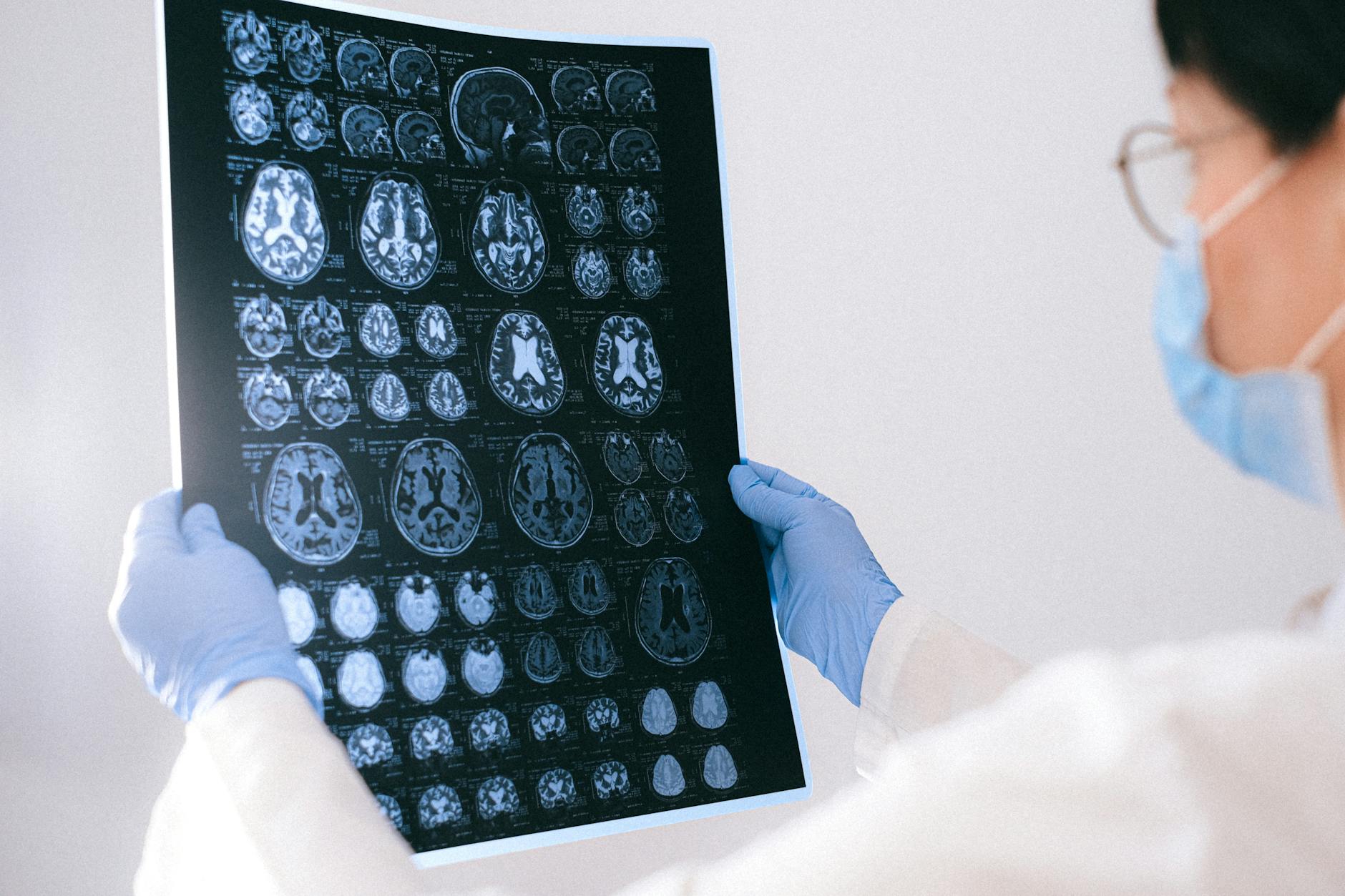 Alzheimer Medikamente Risiko Symbolbild zum Thema Alzheimer Medikamente Risiko